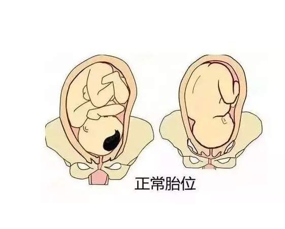 孕晚期胎位會變嗎 如何糾正胎位不正