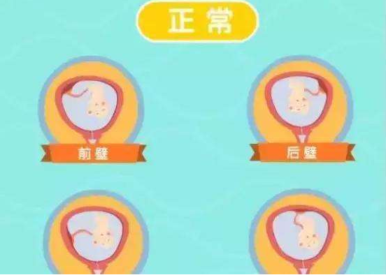 子宮前壁肌瘤影響懷孕嗎 患了子宮肌瘤怎么辦 子宮前壁肌瘤影響懷孕嗎 患了子宮肌瘤怎么辦