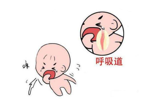 寶寶氣虛的癥狀有哪些 孩子氣虛表現(xiàn)一覽 寶寶氣虛的癥狀有哪些 孩子氣虛表現(xiàn)一覽