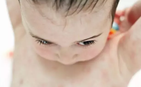 寶寶脾虛吃什么好 孩子脾虛食譜推薦 寶寶脾虛吃什么好 孩子脾虛食譜推薦