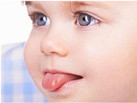 寶寶舌系帶過短是怎么回事 寶寶舌頭短說話不清楚嗎 寶寶舌系帶過短是怎么回事 寶寶舌頭短說話不清楚嗎