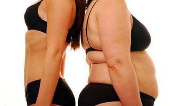 肥胖紋怎么消除 出現肥胖紋是怎么回事