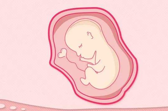 什么是新生兒胎糞吸入綜合征 如何預防胎糞吸入綜合征