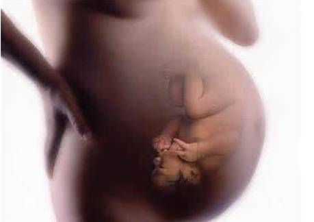 什么是新生兒胎糞吸入綜合征 如何預防胎糞吸入綜合征