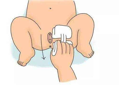 為什么4歲以下的女寶寶容易得小陰唇粘連 寶寶小陰唇粘連怎么預(yù)防