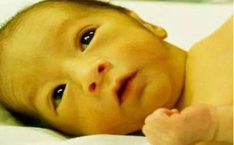 新生兒黃疸喝葡萄糖水可以去黃嗎 新生兒黃疸怎么去得快