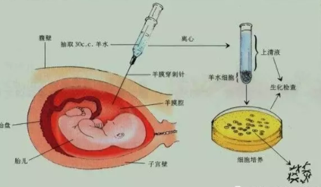 產前診斷有哪些項目 產前診斷項目介紹 產前診斷有哪些項目 產前診斷項目介紹