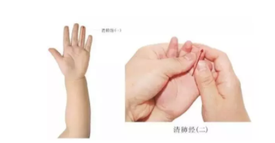 寶寶得了風疙瘩怎么辦  風疙瘩推拿治療方法