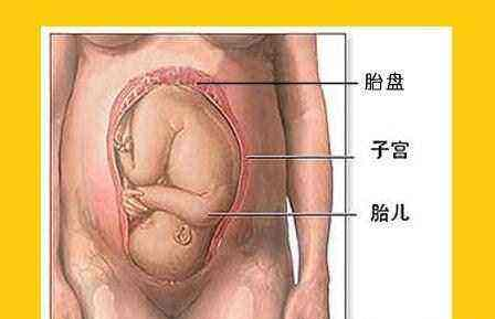 胎盤過厚是什么原因 胎盤增厚有什么影響 胎盤過厚是什么原因 胎盤增厚有什么影響