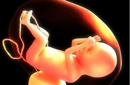 臍帶血穿刺是什么樣的感覺 臍帶血穿刺有必要做嗎