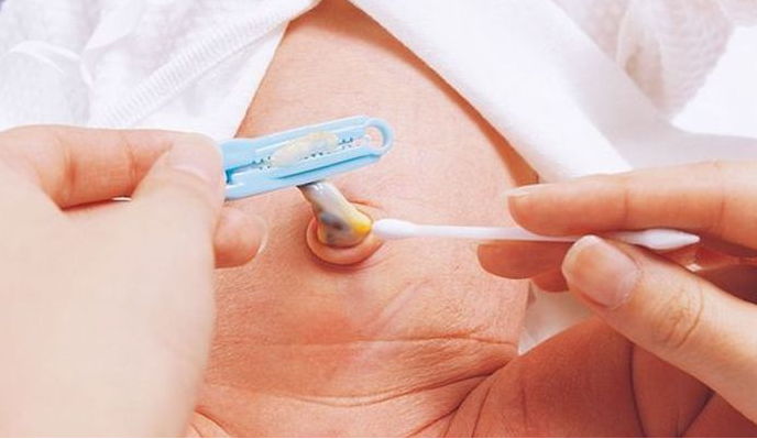 新生兒肚臍感染會導(dǎo)致敗血癥嗎 新生兒肚臍護(hù)理方法