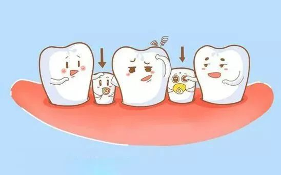 孩子雙排牙要不要拔 雙排牙的形成原因是什么