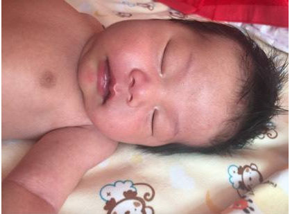 為什么寶寶口唇會(huì)發(fā)紫 寶寶嘴唇發(fā)紫怎么處理