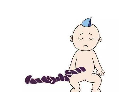 寶寶臍帶扭轉和睡姿有關嗎 寶寶臍帶扭轉是怎么回事
