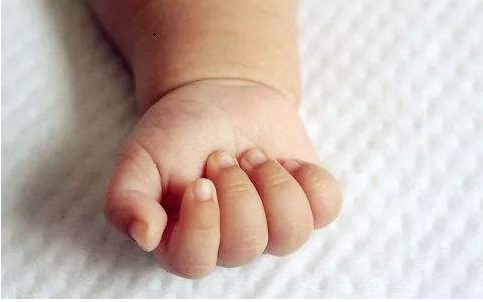 寶寶手上長倒刺是缺乏維生素嗎 寶寶手上長倒刺怎么辦