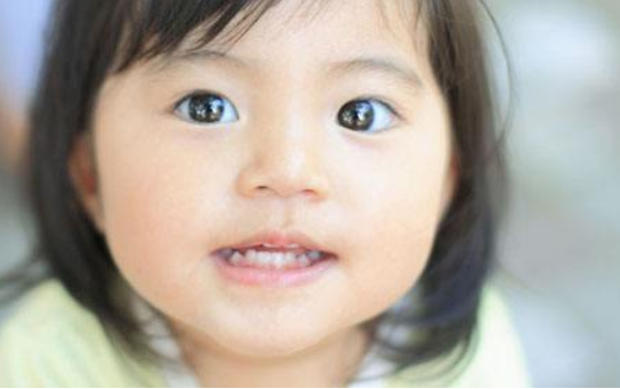 兒童斜視什么時間治療最好 如何判斷兒童斜視