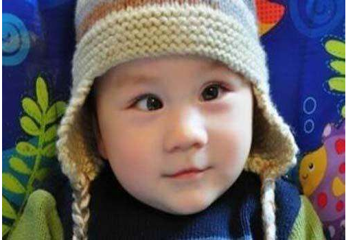 兒童斜視什么時間治療最好 如何判斷兒童斜視