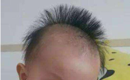 寶寶頭發(fā)豎著長是怎么回事 寶寶頭發(fā)豎著長正常嗎 寶寶頭發(fā)豎著長是怎么回事 寶寶頭發(fā)豎著長正常嗎