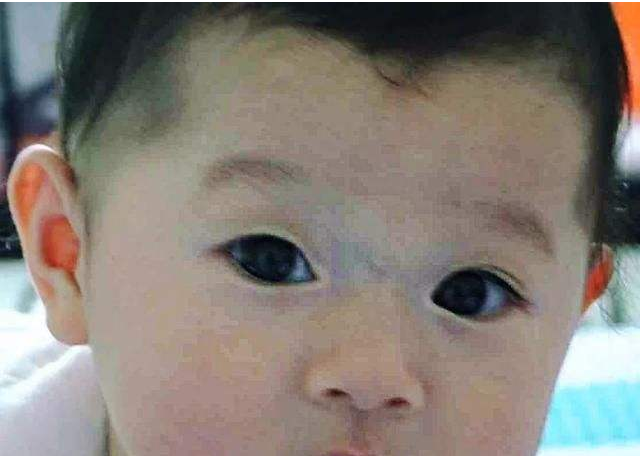 寶寶鼻梁上有青筋是不好帶嗎 寶寶鼻梁上有青筋怎么辦
