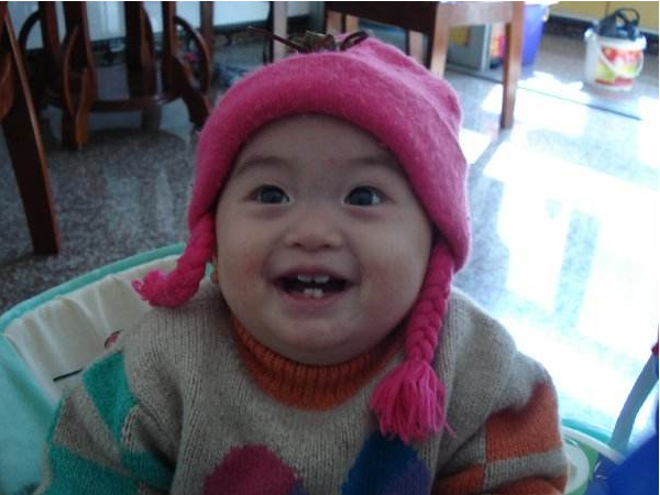 寶寶乳牙縫隙大正常嗎 寶寶門牙縫隙大怎么辦 寶寶乳牙縫隙大正常嗎 寶寶門牙縫隙大怎么辦