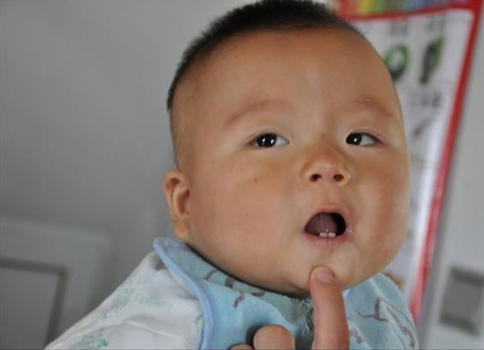 寶寶乳牙縫隙大正常嗎 寶寶門牙縫隙大怎么辦 寶寶乳牙縫隙大正常嗎 寶寶門牙縫隙大怎么辦