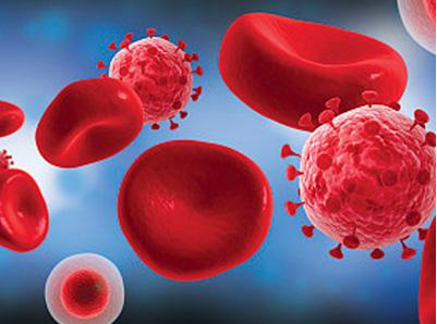 生殖器皰疹會傳染嗎 生殖器皰疹潛伏期是多久 生殖器皰疹會傳染嗎 生殖器皰疹潛伏期是多久