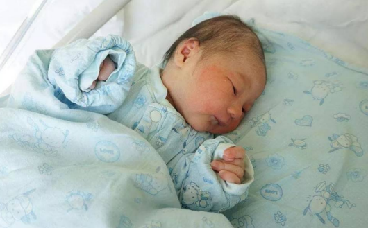 母乳性黃疸怎么辦 母乳性黃疸解決方法 母乳性黃疸怎么辦 母乳性黃疸解決方法