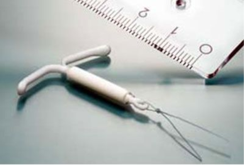 曼月樂環(huán)可以治療子宮腺肌癥嗎 曼月樂環(huán)有什么副作用