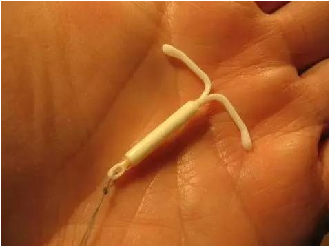 曼月樂環會使人衰老嗎 什么時候放曼月樂環好 曼月樂環會使人衰老嗎 什么時候放曼月樂環好