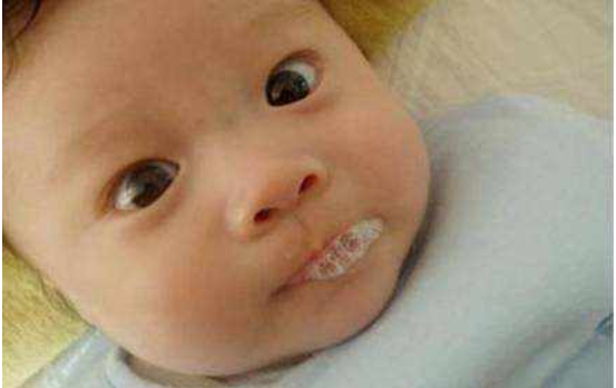 寶寶愛吐泡泡就是肺炎的表現(xiàn)嗎  寶寶總是吐泡泡怎么辦