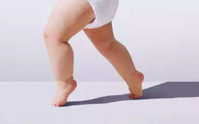 寶寶走路愛踮腳正常嗎 寶寶走路愛踮腳怎么辦 寶寶走路愛踮腳正常嗎 寶寶走路愛踮腳怎么辦