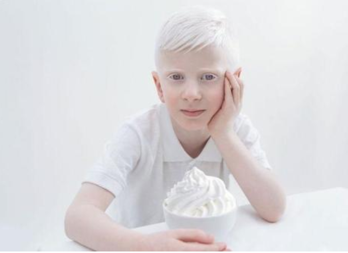 小孩白化病是怎么引起的 小孩白化病可以治愈嗎