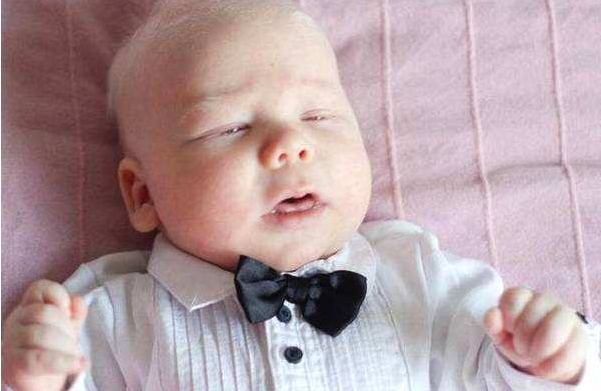 小孩白化病是怎么引起的 小孩白化病可以治愈嗎