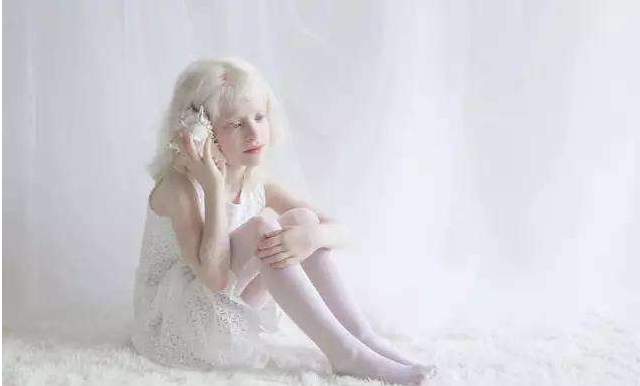 小孩白化病是怎么引起的 小孩白化病可以治愈嗎