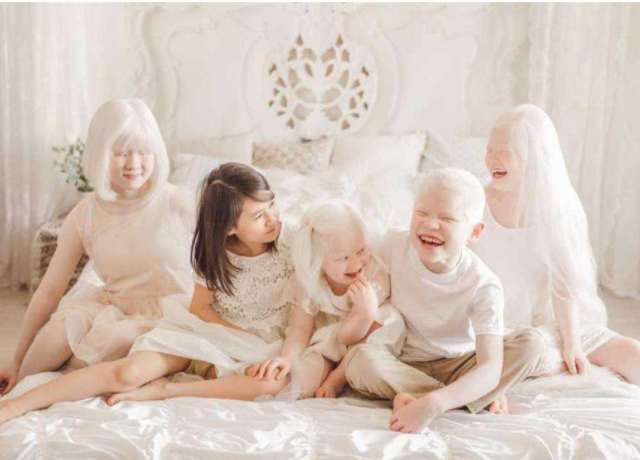 白化病產(chǎn)前檢查能查出來嗎 白化病能活多久 白化病產(chǎn)前檢查能查出來嗎 白化病能活多久