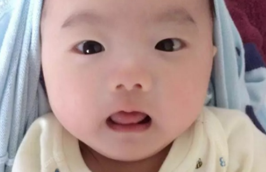 新生兒眼皮上紅斑會消失嗎 新生兒紅斑有哪些 新生兒眼皮上紅斑會消失嗎 新生兒紅斑有哪些