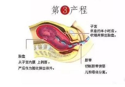 生孩子時該怎樣用力 生孩子不會使勁怎么辦