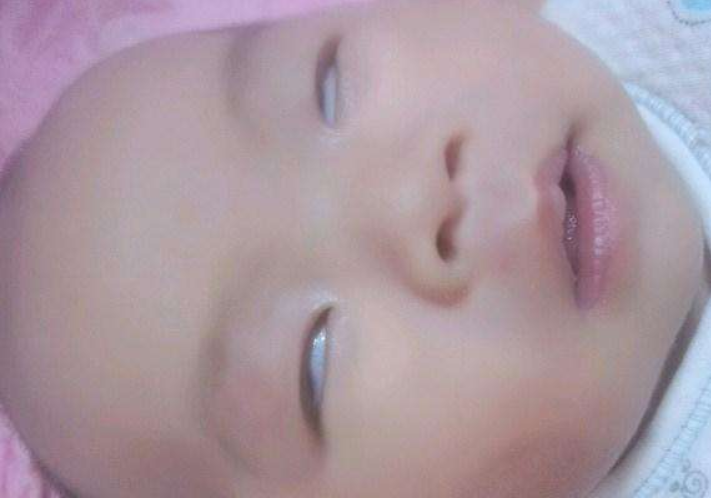 寶寶睡覺翻白眼正常嗎 寶寶睡覺翻白眼是怎么回事