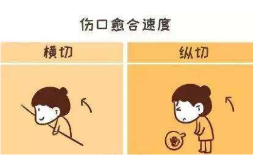 剖腹產橫切還是豎切好 剖腹產橫切豎切優缺點