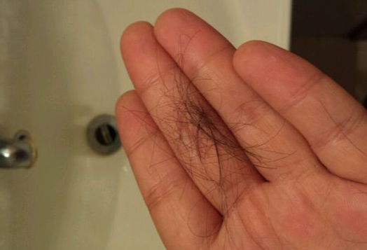 產后脫發吃什么好 產后脫發食物調理方法 產后脫發吃什么好 產后脫發食物調理方法