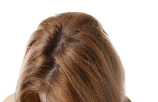 產(chǎn)后脫發(fā)的正確調(diào)理方法 產(chǎn)后脫發(fā)怎么改善 產(chǎn)后脫發(fā)的正確調(diào)理方法 產(chǎn)后脫發(fā)怎么改善