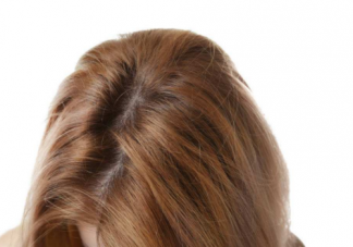 產后脫發(fā)的正確調理方法    產后脫發(fā)怎么改善