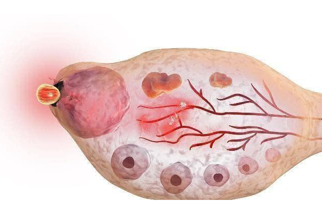 女性卵子是什么樣的 女性一個月排幾個卵子 女性卵子是什么樣的 女性一個月排幾個卵子