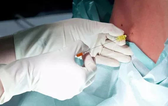 所有孕婦都可以無痛分娩嗎   無痛分娩有哪些要求