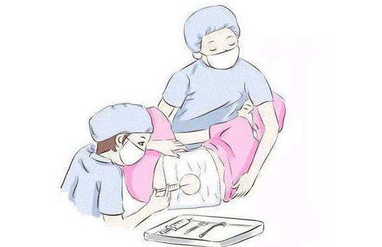 無痛分娩有效果嗎 無痛分娩注意事項 無痛分娩有效果嗎 無痛分娩注意事項