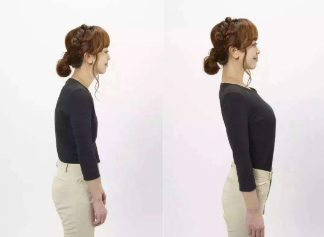 孩子含胸駝背怎么辦 孩子駝背怎么糾正