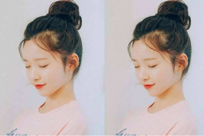 產后發際線后移怎么辦 產后發際線后移怎么護理 產后發際線后移怎么辦 產后發際線后移怎么護理