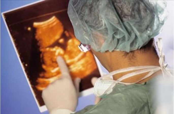 羊水過多是胎兒畸形嗎 羊水過多有什么危害 羊水過多是胎兒畸形嗎 羊水過多有什么危害