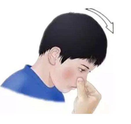 寶寶流鼻血就是上火嗎 一定不要搞錯了