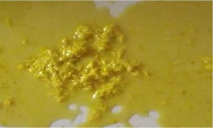 新生兒大便什么顏色正常 新生兒大便顏色異常怎么辦 新生兒大便什么顏色正常 新生兒大便顏色異常怎么辦